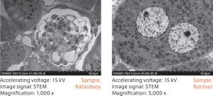 STEM examples
